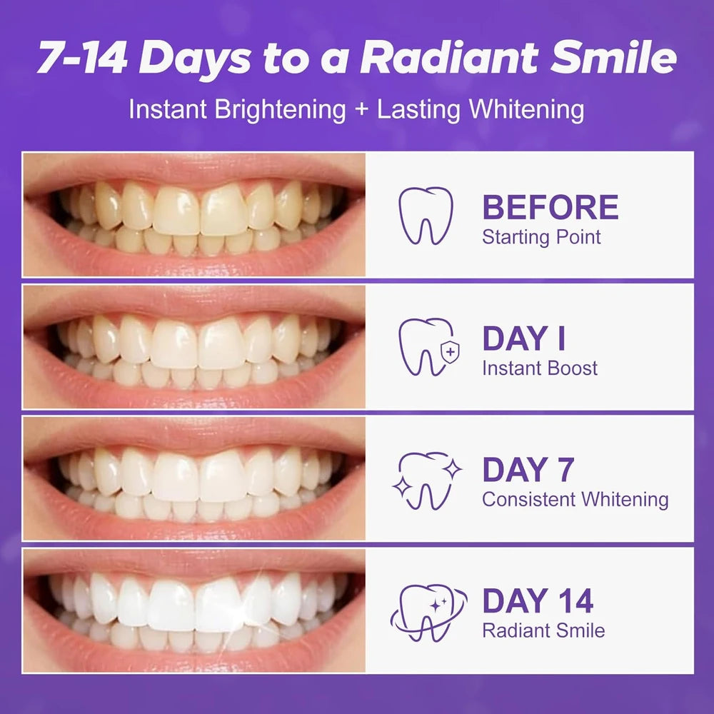 Whitening Teeth Strips